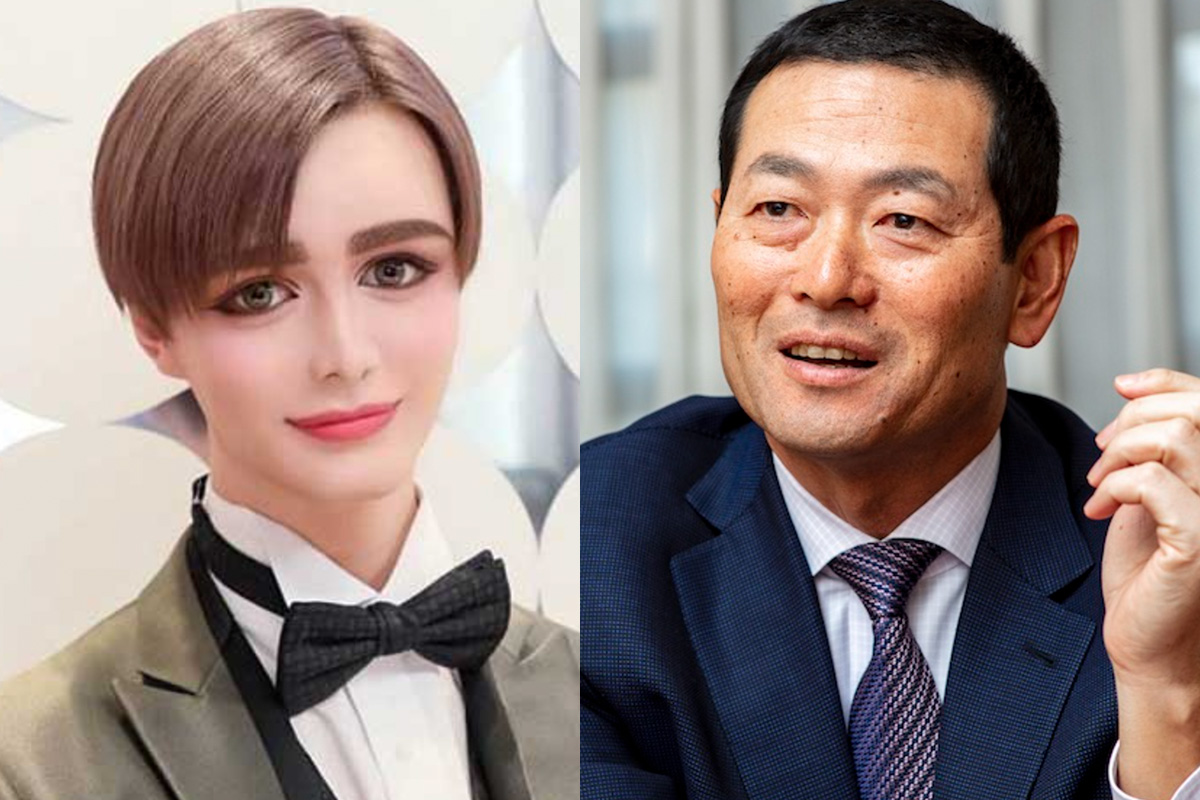Matt(マット)の整形箇所は4つ!?過去昔と今の写真画像を比較!高須医院長の徹底分析! - ワサガシ
