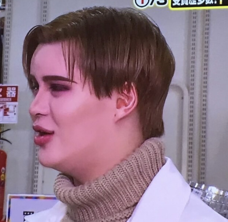 Matt(マット)太った顔がパンパンに!?過去昔と今の写真画像を比較! - ワサガシ
